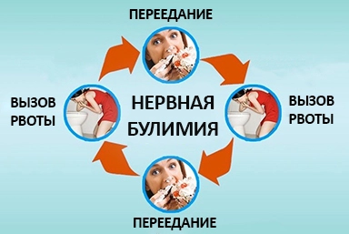 Лечение булимии в Луге